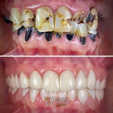 Slider image (4) Dental Artistry Dental Center